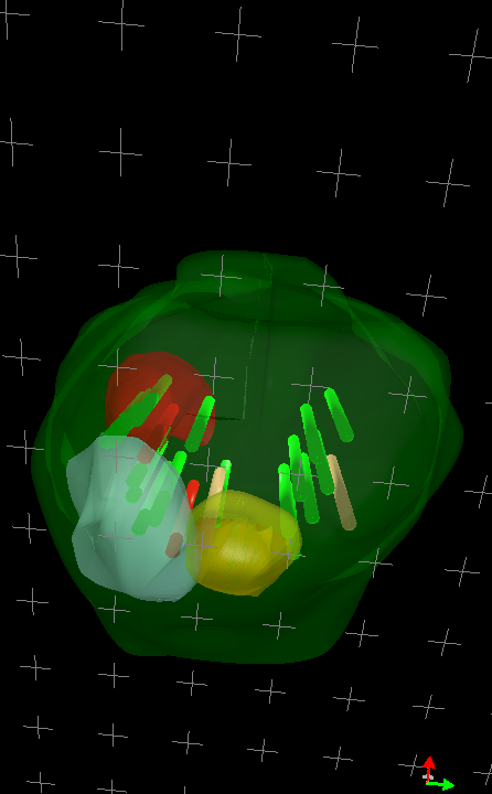 3d βιοψιες-1