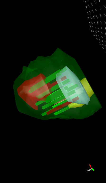 3d βιοψίες-2